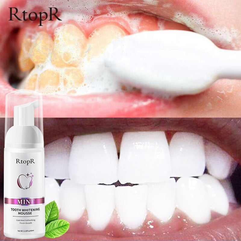 Tooth Whitening Mousse - R&A LUXE